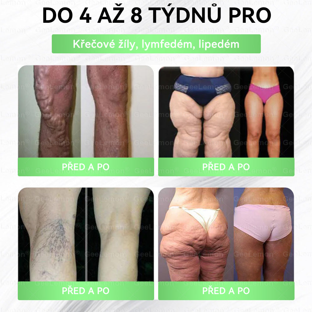 ❤️❤️ 𝐆𝐞𝑒𝑙𝑒𝐦𝐨𝐧® Glum𝐚𝐬𝐞tide 8 v 1 – Zeštíhlující nano mikrojihlový náplast 🇨🇿 Jen 1× denně ✅ Viditelné změny za 7 dní – na obezitu, kardiovaskulární zdraví, diabetes a kloubní problémy